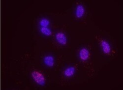 MSH6 Antibody, Novus Biologicals 0.1mg; Unlabeled:Antibodies, Polyclonal