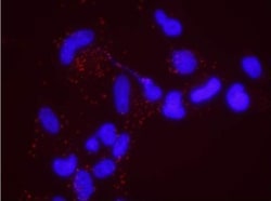 MSH6 Antibody, Novus Biologicals 0.1mg; Unlabeled:Antibodies, Polyclonal