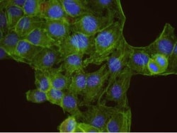 MSH6 Antibody, Novus Biologicals 0.1mg; Unlabeled:Antibodies, Polyclonal