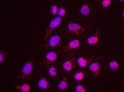 MSH6 Antibody, Novus Biologicals 0.1mg; Unlabeled:Antibodies, Polyclonal