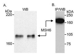 MSH6 Antibody, Novus Biologicals 100 &mu;L | Buy Online | Novus Biologicals | Fisher Scientific
