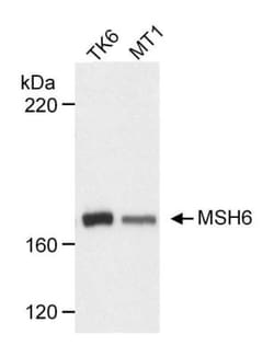 MSH6 Antibody, Novus Biologicals 0.1mg; Unlabeled:Antibodies, Polyclonal