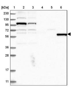 MSL3L1 Antibody, Novus Biologicals 0.1mL; Unlabeled:Antibodies, Polyclonal