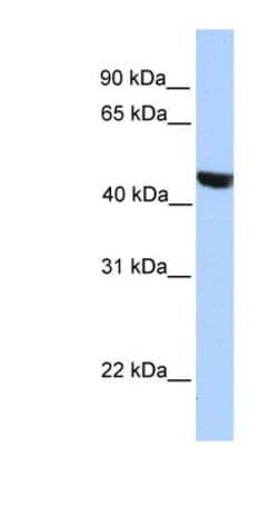 MSL3P1 Antibody, Novus Biologicals 100 &mu;L | Buy Online | Novus Biologicals | Fisher Scientific
