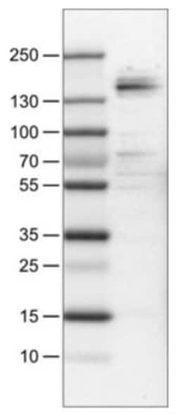 MSPR/Ron Antibody (CL0463), Novus Biologicals:Antibodies:Primary Antibodies