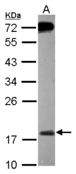 MSRB2 Antibody, Novus Biologicals 0.1mL; Unlabeled:Antibodies, Polyclonal