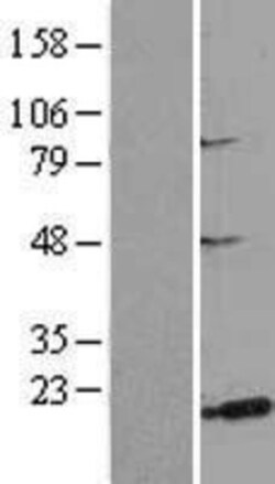 Novus Biologicals&trade;&nbsp;MSRB3 Overexpression Lysate