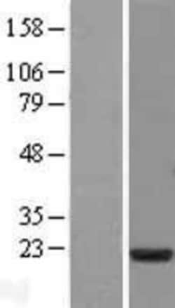 Novus Biologicals&trade;&nbsp;MSRB3 Overexpression Lysate