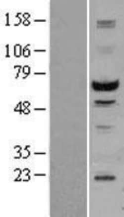 Novus Biologicals&trade;&nbsp;MST2/STK3 Overexpression Lysate