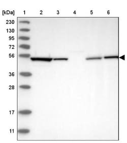 MST3 Antibody, Novus Biologicals:Antibodies:Primary Antibodies