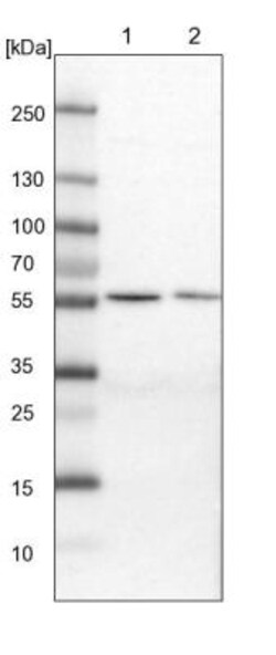 MST3 Antibody, Novus Biologicals 0.1mL; Unlabeled:Antibodies, Polyclonal