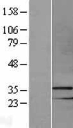 Novus Biologicals&trade;&nbsp;MSX1 Overexpression Lysate