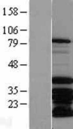 Novus Biologicals™ MSX2 Overexpression Lysate