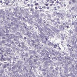 MSY2 Antibody, Novus Biologicals 25 &mu;L, Unlabeled:Antibodies, Polyclonal