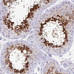 MSY2 Antibody, Novus Biologicals 25 &mu;L, Unlabeled:Antibodies, Polyclonal