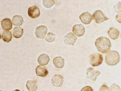 MTA2 Antibody - BSA Free, Novus Biologicals 0.1mg; Unlabeled:Antibodies,