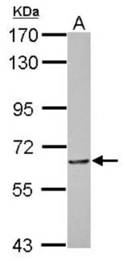 MTA3 Antibody, Novus Biologicals 0.1mL; Unlabeled:Antibodies, Polyclonal