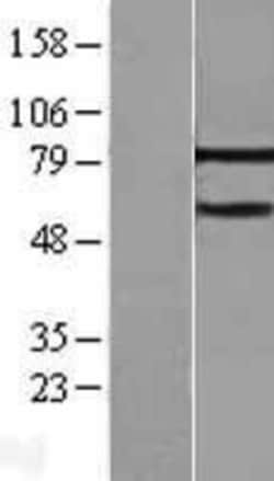 Novus Biologicals&trade;&nbsp;MTA3 Overexpression Lysate