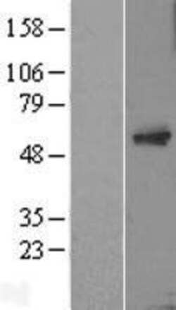 Novus Biologicals&trade;&nbsp;MTAC2D1 Overexpression Lysate
