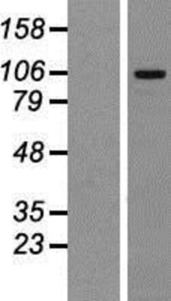 Novus Biologicals&trade;&nbsp;MTBP Overexpression Lysate