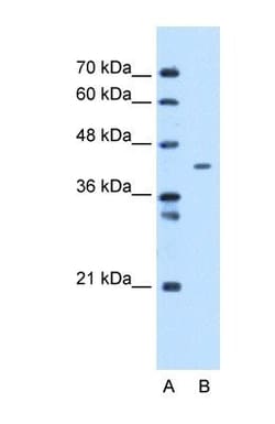 MTCH1 Antibody, Novus Biologicals 0.05mg; Unlabeled:Antibodies, Polyclonal