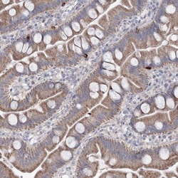 MTCH2 Antibody, Novus Biologicals:Antibodies:Primary Antibodies