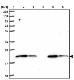MT-CO2 Antibody, Novus Biologicals 0.1mL; Unlabeled:Antibodies, Polyclonal