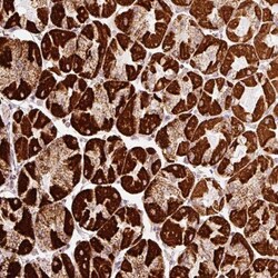 MT-CO2 Antibody, Novus Biologicals 0.1mL; Unlabeled:Antibodies, Polyclonal