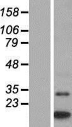 Novus Biologicals&trade;&nbsp;MTCP1 Overexpression Lysate