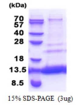 Novus Biologicals&trade;&nbsp;Recombinant Human MTCP1NB His Protein
