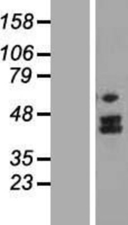 Novus Biologicals&trade;&nbsp;MTERFD2 Overexpression Lysate