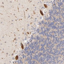 MTERFD3 Antibody, Novus Biologicals:Antibodies:Primary Antibodies