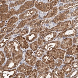 MTF1 Antibody, Novus Biologicals 25 &mu;L; Unlabeled:Antibodies, Polyclonal
