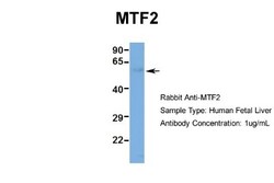 MTF2 Antibody, Novus Biologicals 100 &mu;L | Buy Online | Novus Biologicals | Fisher Scientific