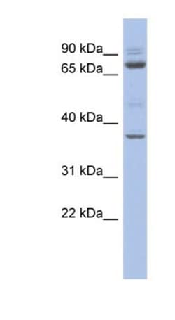 MTF2 Antibody, Novus Biologicals 100 &mu;L | Buy Online | Novus Biologicals | Fisher Scientific