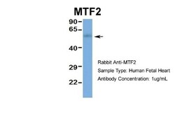 MTF2 Antibody, Novus Biologicals 100 &mu;L | Buy Online | Novus Biologicals | Fisher Scientific