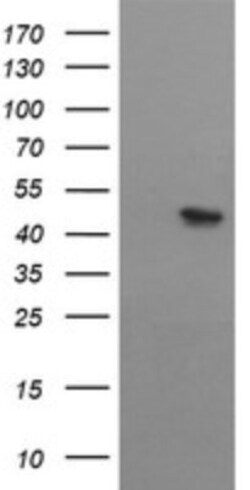 MTFMT Antibody (OTI2A2), Novus Biologicals 0.1mL; Unlabeled:Antibodies,