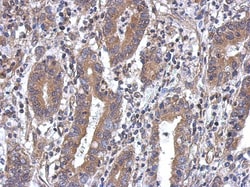 MTG1 Antibody, Novus Biologicals 0.1mL; Unlabeled:Antibodies, Polyclonal