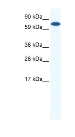 MTGR1 Antibody, Novus Biologicals 100&mu;L; Unlabeled:Antibodies, Polyclonal