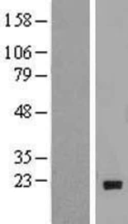 Novus Biologicals&trade;&nbsp;MTH1 Overexpression Lysate