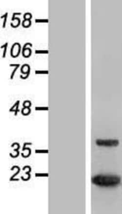 Novus Biologicals&trade;&nbsp;MTH1 Overexpression Lysate