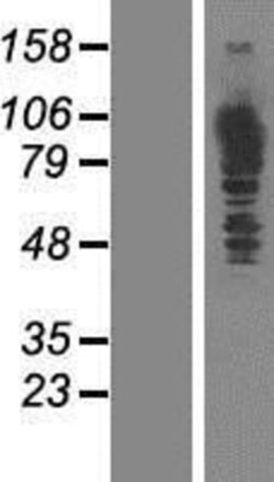 Novus Biologicals&trade;&nbsp;MTHFD1 Overexpression Lysate