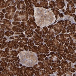 MTHFD1 Antibody, Novus Biologicals 25 &mu;L; Unlabeled:Antibodies, Polyclonal