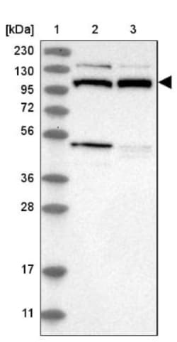 MTHFD1L Antibody, Novus Biologicals 25 &mu;L | Buy Online | Novus Biologicals | Fisher Scientific