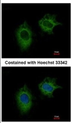 MTHFD2 Antibody, Novus Biologicals 0.1mL; Unlabeled:Antibodies, Polyclonal