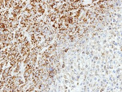 MTHFD2 Antibody, Novus Biologicals 0.1mL; Unlabeled:Antibodies, Polyclonal