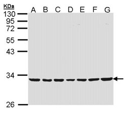 MTHFD2 Antibody, Novus Biologicals 0.1mL; Unlabeled:Antibodies, Polyclonal