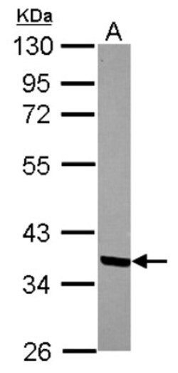 MTHFD2 Antibody, Novus Biologicals 0.1mL; Unlabeled:Antibodies, Polyclonal