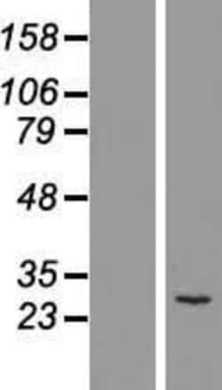 Novus Biologicals&trade;&nbsp;MTHFD2 Overexpression Lysate