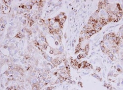 MTHFD2 Antibody, Novus Biologicals 0.1mL; Unlabeled:Antibodies, Polyclonal